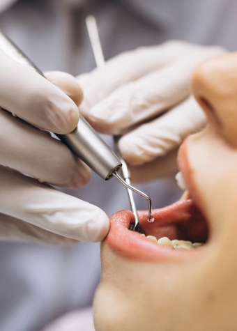 Endodontia (Canal)