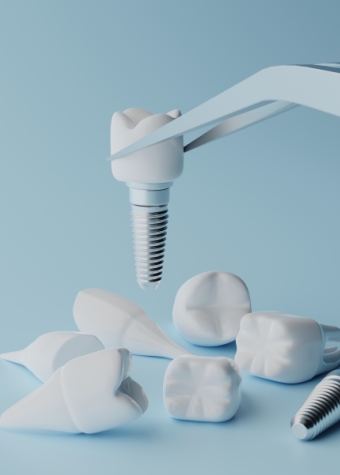 Implantes